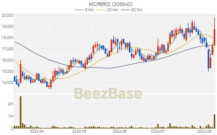 [주가 차트] 바디텍메드 - 206640 (2024.08.08)