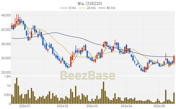 [주가 차트] 뷰노 - 338220 (2024.05.17)