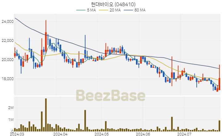 현대바이오 주가 분석 및 주식 종목 차트 | 2024.07.25