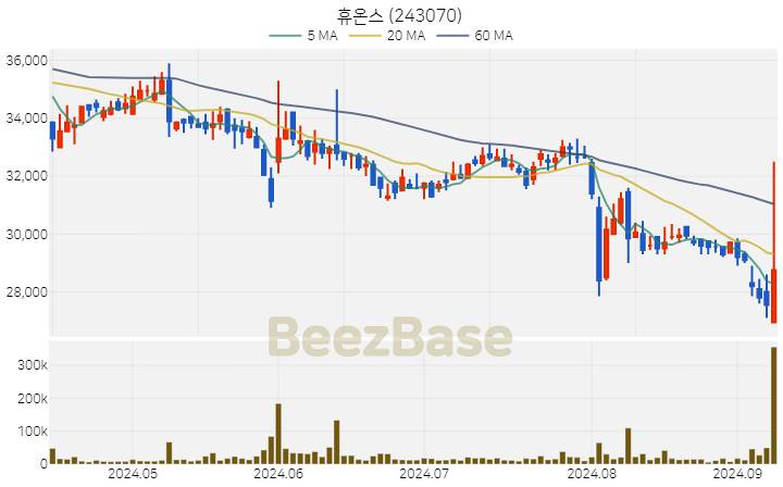 휴온스 주가 분석 및 주식 종목 차트 | 2024.09.09